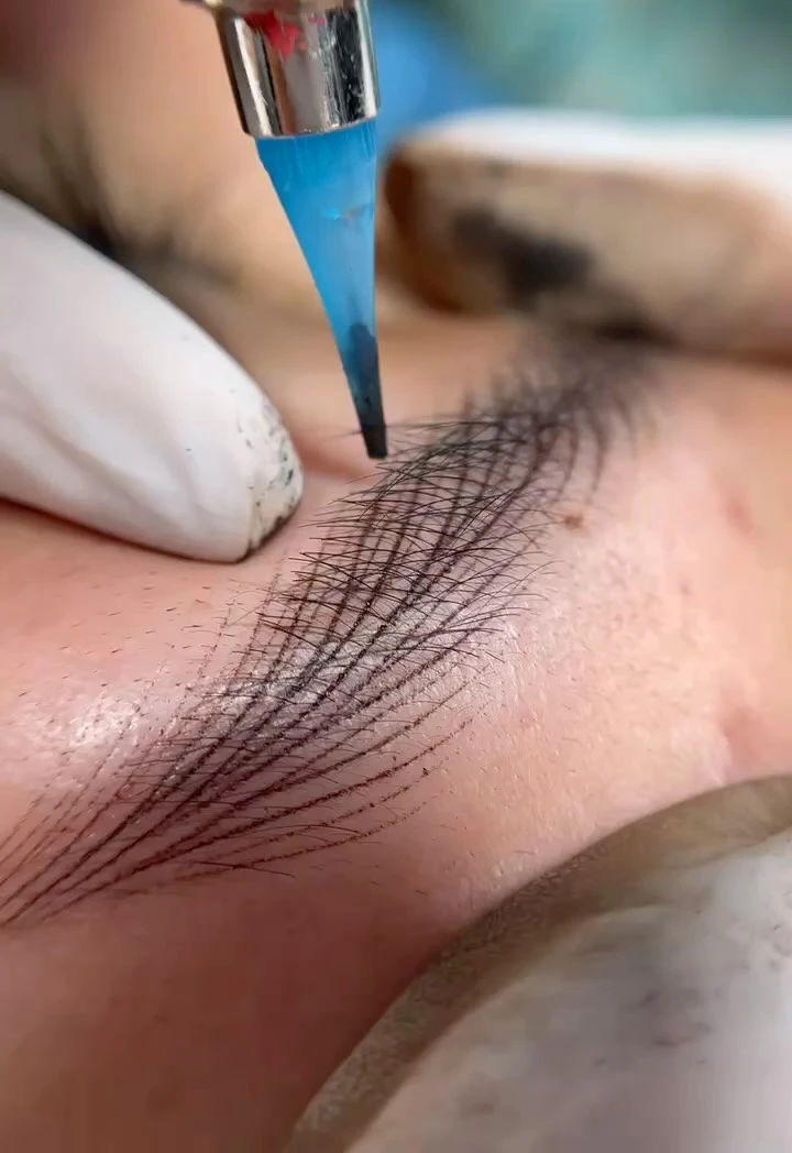 brow